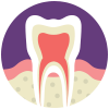 Root Canal Service